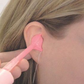 Abdrucknahme für Otoplastik