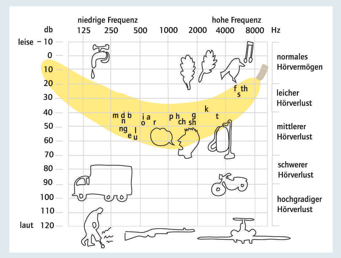 Audiogramm mit Sprachbanane